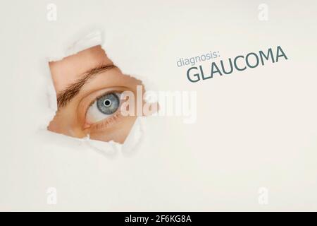 Woman`s eye looking trough teared hole in paper, word Glaucoma on right. Eye disease concept template. grey background. Stock Photo